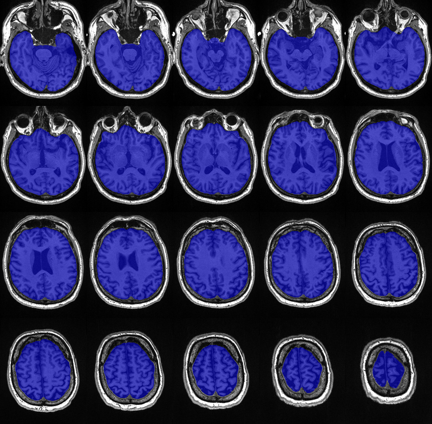 Quality control image for icv segmentation